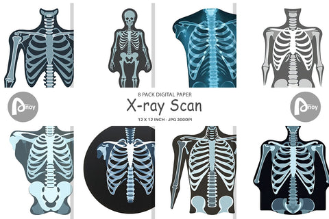 X-ray Scan (1).jpg