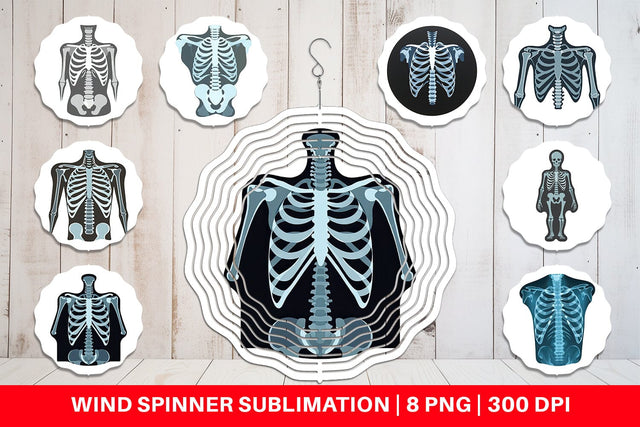 Wind Spinner X-Ray Scan Sublimation artnoy 