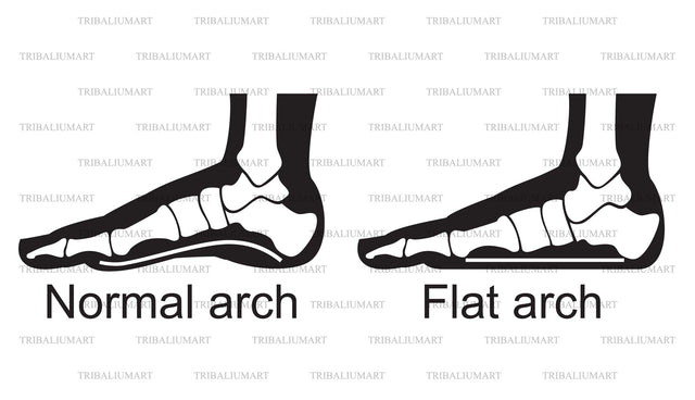 Human anatomy - flat and normal arch SVG TribaliumArtSF 