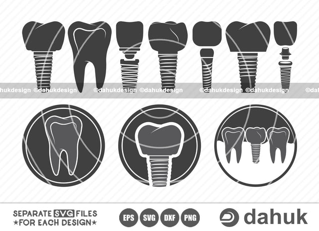 Tooth implant SVG, Implant icon, Icon fonts, Dentist, Dental implant icon, Dental implant vector, Cut file, for silhouette, svg, eps, dxf, png, clipart cricut design space, vinyl cut files SVG dahukdesign 